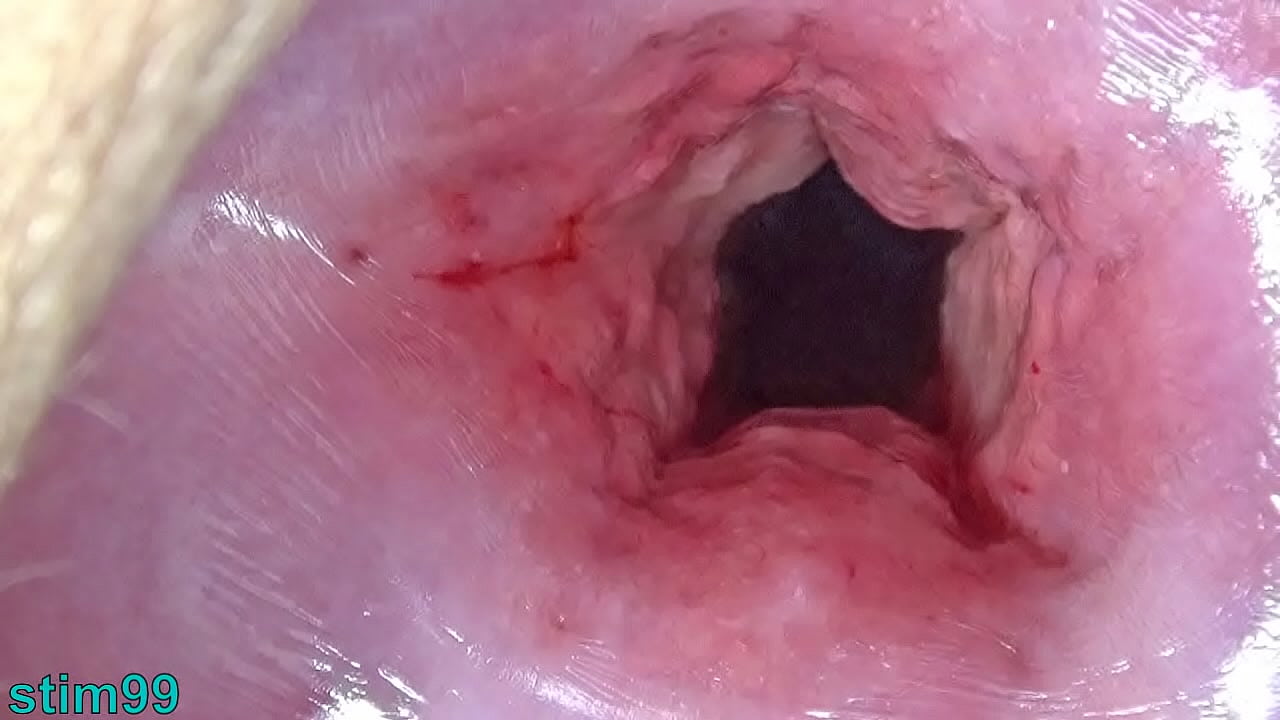 betty ours recommends cervix stretching porn pic