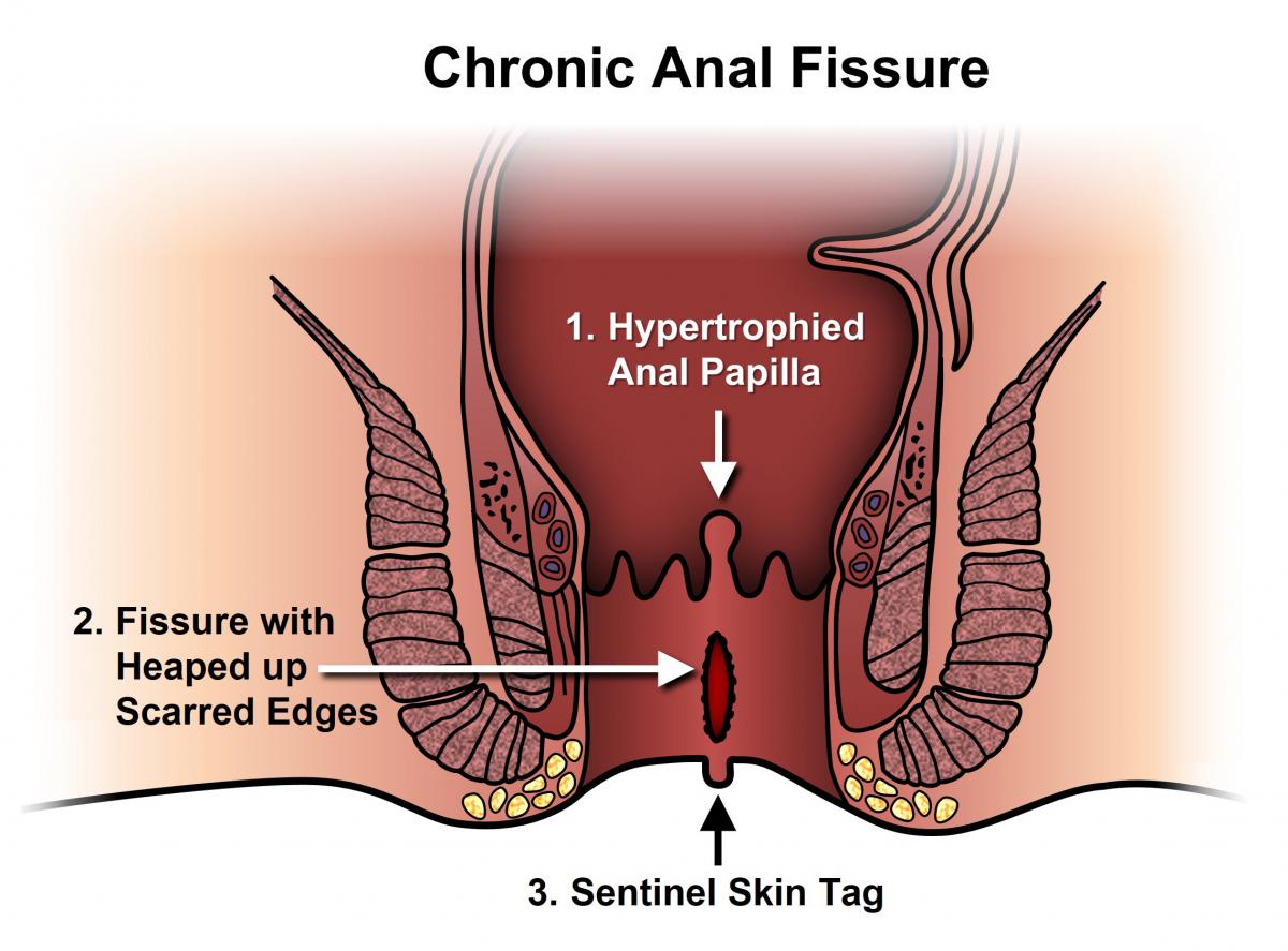 chad shropshire recommends anal in dubai pic