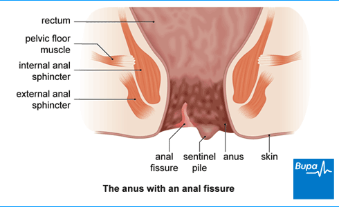 angela melisa recommends anal in dubai pic