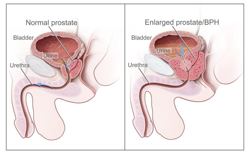 denise lint recommends Cum During Prostate Exam