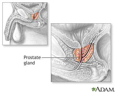 chris nicolaysen add cum during prostate exam photo